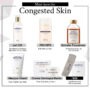 Must-Haves for Congested Skin